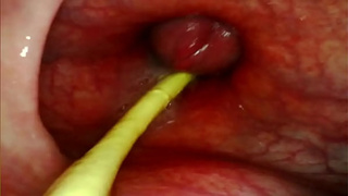EXTREME ANAL SELF PERSPECTIVE. WEBCAM INSIDE HER ASS-HOLE AS I POUND HER WITH MY MONSTROUS PRICK AND JIZZ DEEP INSIDE